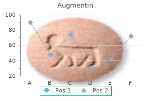 order augmentin 375 mg with amex