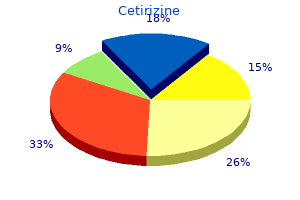 purchase cetirizine 10 mg on line