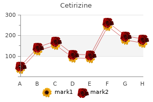 order cetirizine 10 mg fast delivery