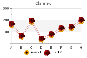 generic 5 mg clarinex overnight delivery