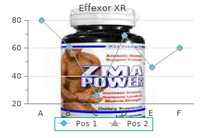 generic effexor xr 150 mg line