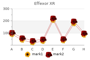 effexor xr 75 mg with visa