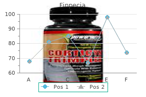 finpecia 1 mg buy discount line