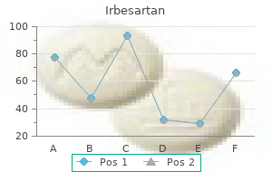 irbesartan 150 mg generic online