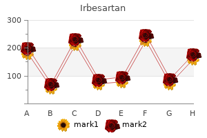 purchase 300 mg irbesartan mastercard