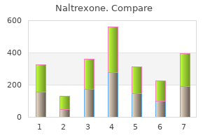 naltrexone 50 mg safe