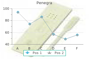 purchase 100 mg penegra with mastercard