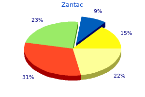 order zantac 150 mg with visa