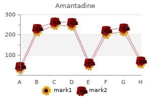 buy amantadine 100 mg with visa