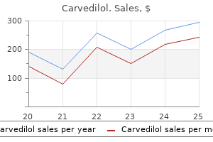 order carvedilol without a prescription
