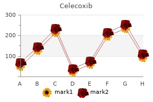 100 mg celecoxib buy free shipping