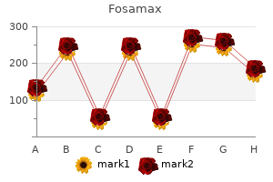 discount 70 mg fosamax with visa