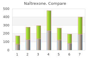 50 mg naltrexone purchase