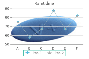 300 mg ranitidine buy
