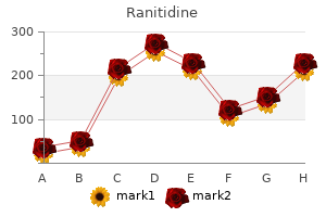 ranitidine 300 mg buy amex