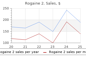 purchase rogaine 2 uk