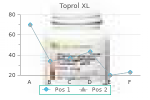 toprol xl 100 mg purchase without prescription
