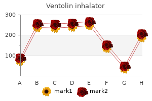 buy 100ml ventolin inhalator fast delivery
