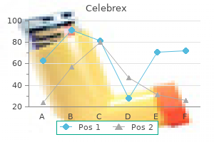 buy celebrex online now