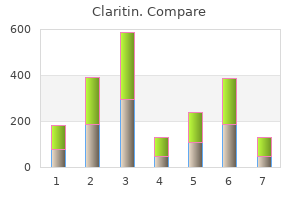 order claritin 10 mg online