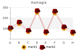 purchase 100 mg kamagra with mastercard
