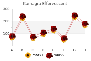 generic 100 mg kamagra effervescent with mastercard