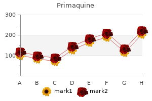 primaquine 7.5 mg order mastercard