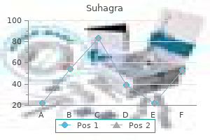 cheap suhagra 50 mg buy online