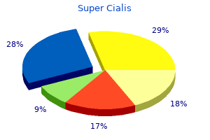 buy 80 mg super cialis fast delivery