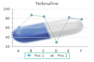 generic 250 mg terbinafine with amex